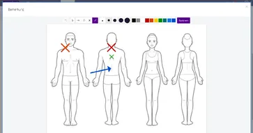 Mit digitalisierten Körperdiagrammen können Sie jedes Bild im Patientendossier skizzieren und an einen Termin oder Patienten anhängen.
